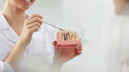 Descoperire-implant-Velvet-Dental